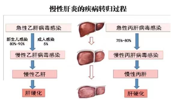 【健康科普】世界肝炎日——堅持早預防，加強檢測發(fā)現(xiàn)，規(guī)范抗病毒治療